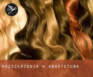 Rozszerzenia w Abaetetuba Rozszerzenia w Abaetetuba