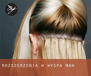 Rozszerzenia w Wyspa Man Rozszerzenia w Wyspa Man