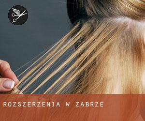 Rozszerzenia w Zabrze Rozszerzenia w Zabrze